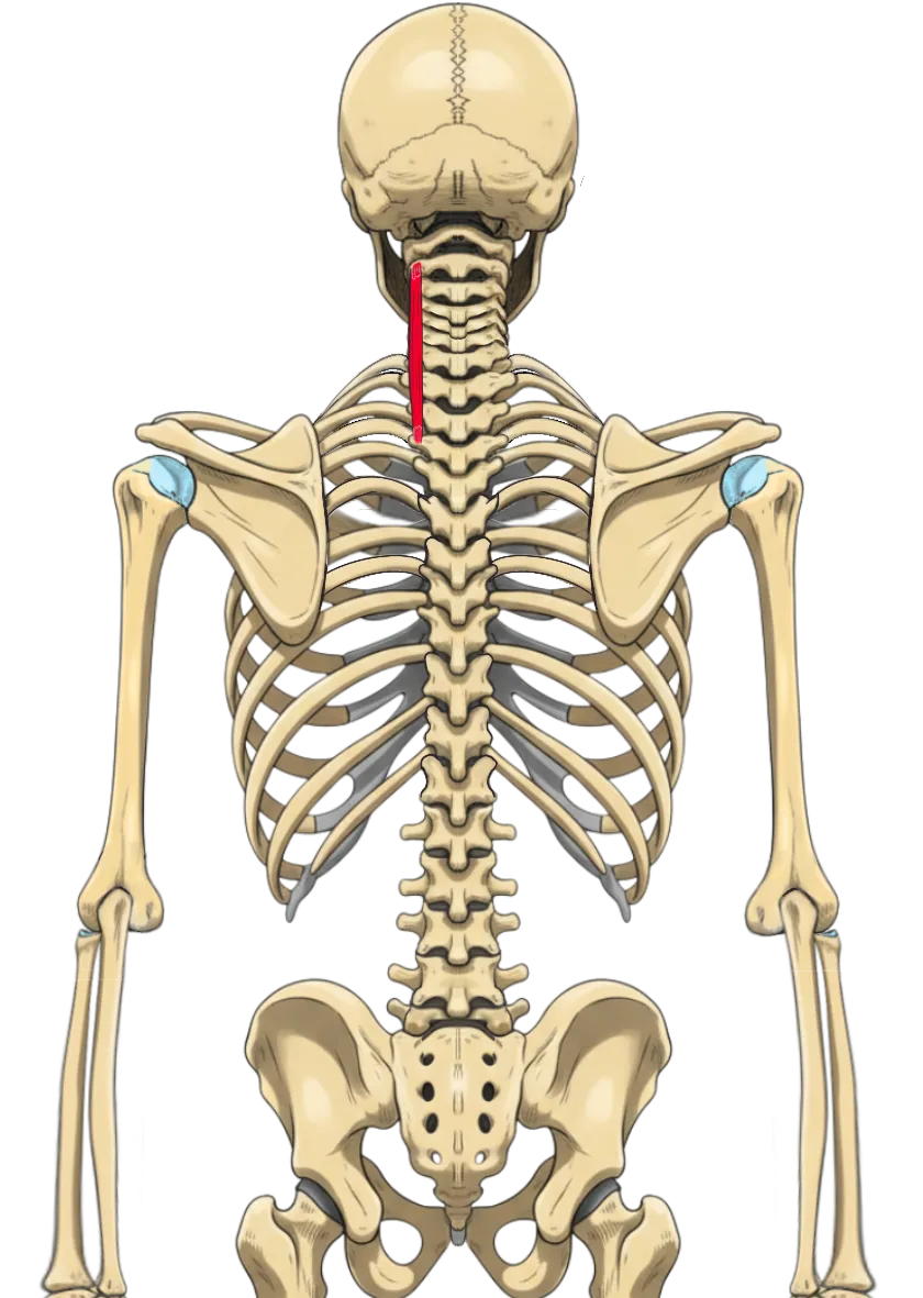 Schéma anatomique du muscle longissimus cervicis, reliant les vertèbres thoraciques supérieures aux processus transverses des vertèbres cervicales C2 à C6